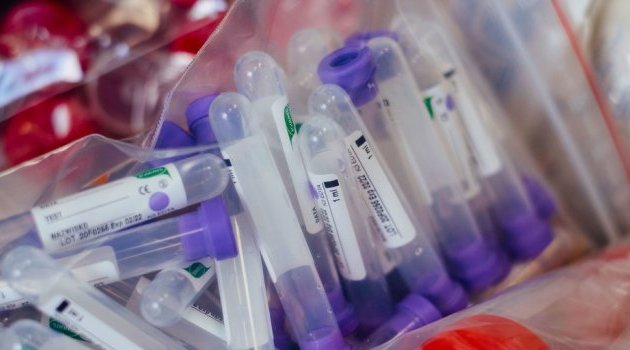 Covid-19&nbsp;: l’OMS est en contact avec Moscou pour évaluer l’efficacité du vaccin russe